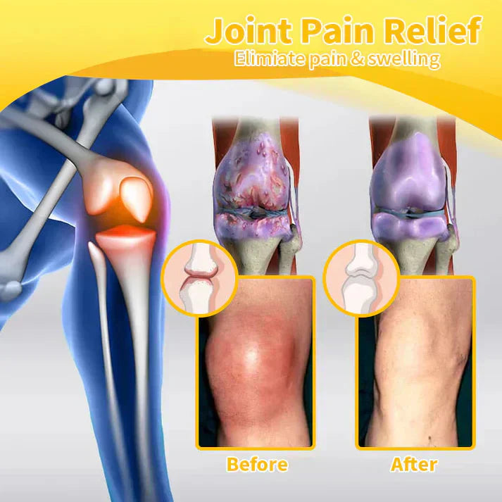 Bee Venom Instant Ultra Strength Pain Relief Therapy Cream🇺🇸