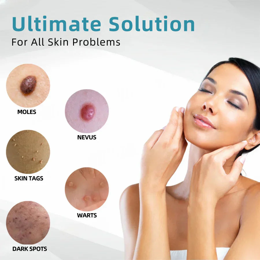 Bikenda® VelvetSkin+ All-in-One Laser Eraser Pen (Powered by CO₂ laser technology – effectively removes moles, warts, skin tags, pigmentation spots, and other skin imperfections)
