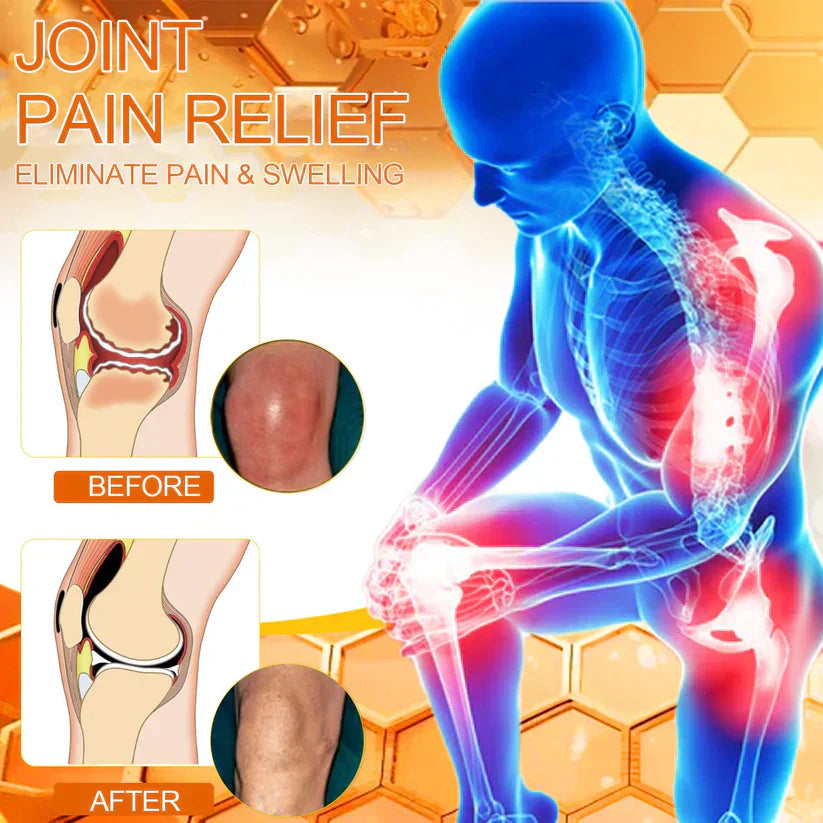 Bee Venom Instant Ultra Strength Pain Relief Therapy Cream🇺🇸