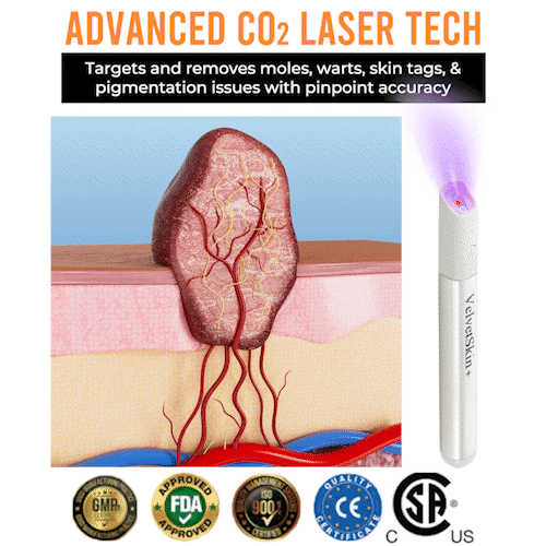 Bikenda® VelvetSkin+ All-in-One Laser Eraser Pen (Powered by CO₂ laser technology – effectively removes moles, warts, skin tags, pigmentation spots, and other skin imperfections)