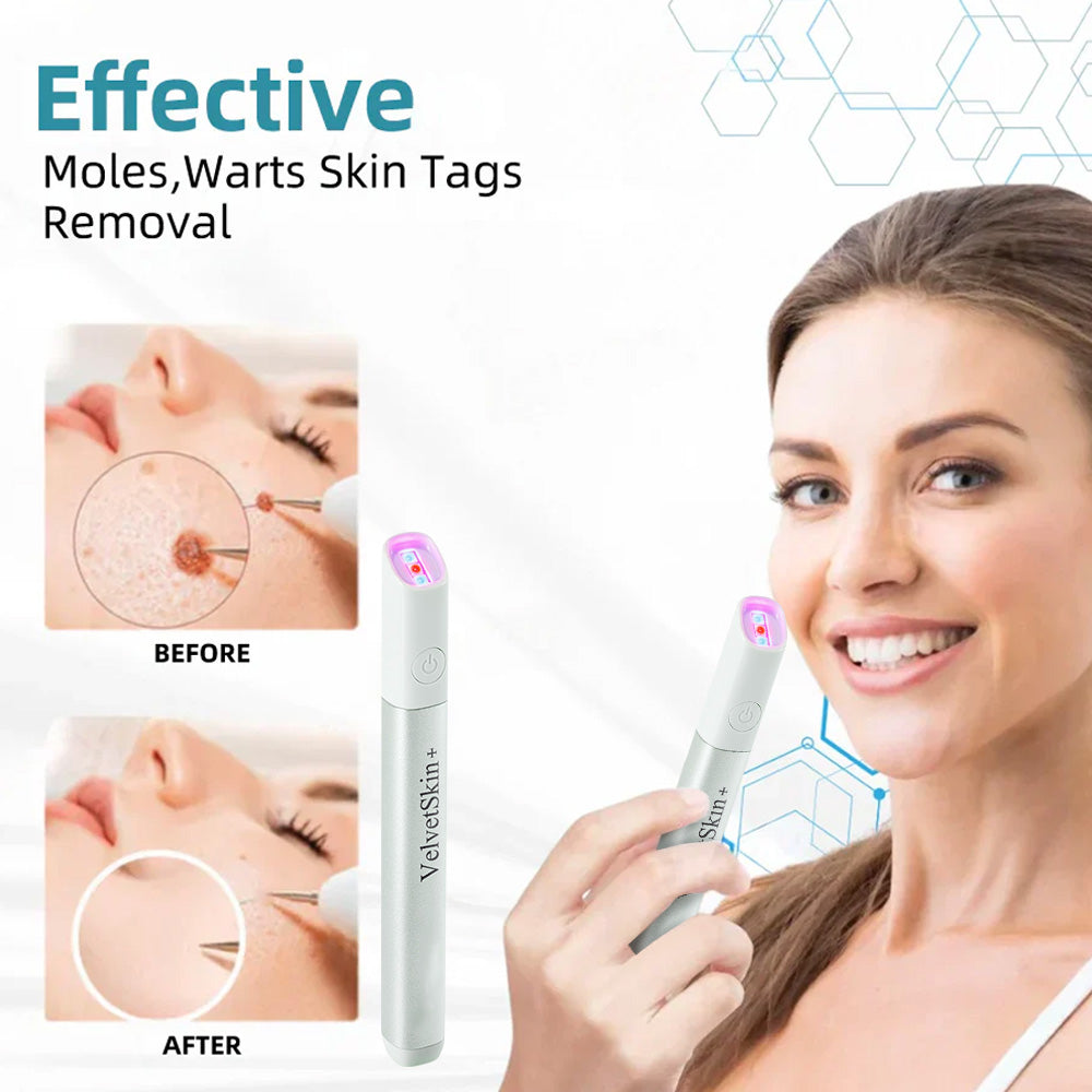 Bikenda® VelvetSkin+ All-in-One Laser Eraser Pen (Powered by CO₂ laser technology – effectively removes moles, warts, skin tags, pigmentation spots, and other skin imperfections)