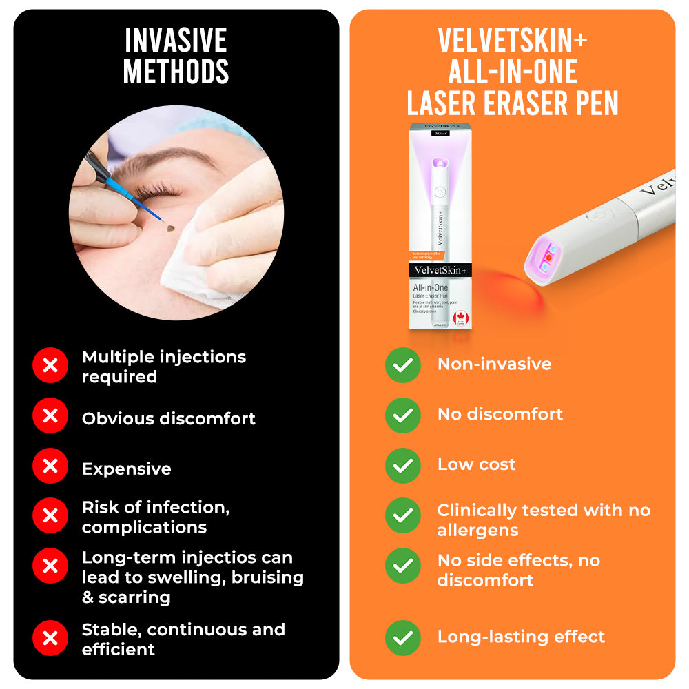 Bikenda® VelvetSkin+ All-in-One Laser Eraser Pen (Powered by CO₂ laser technology – effectively removes moles, warts, skin tags, pigmentation spots, and other skin imperfections)