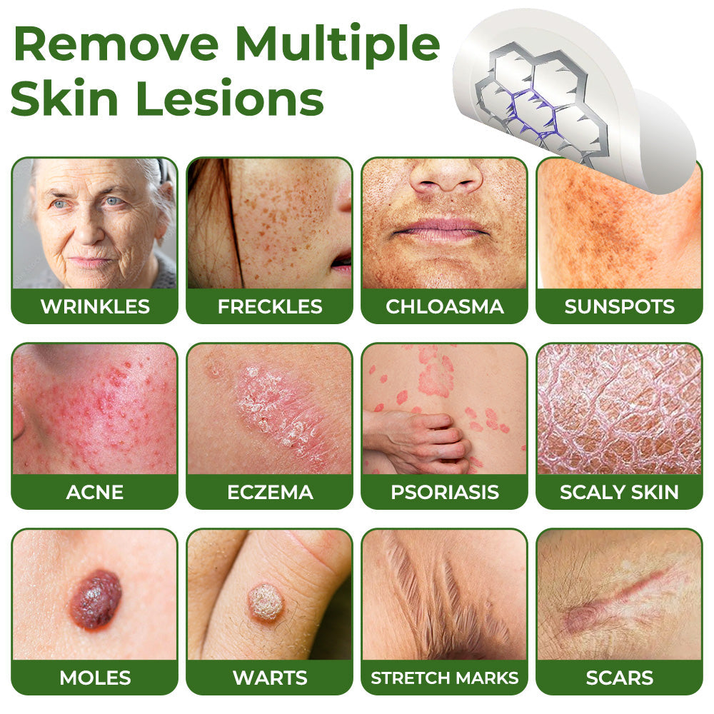 GFOUK® Magnesium MicroNeedle Quick Remove Skin Tag Patches