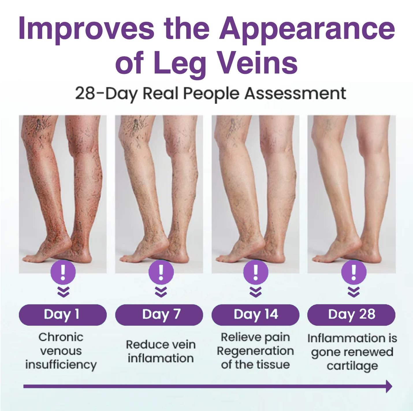 𝐎𝐮𝐫𝐥𝐲𝐚𝐫𝐝® 𝐅𝐞𝐞𝐋𝐞𝐠 𝐂𝐚𝐫𝐞 𝐏𝐡𝐲𝐭𝐨 𝐆𝐞𝐥 - Treat Varicose Veins, Swelling, Cramps, and Leg Pain