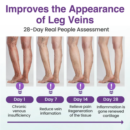 𝐎𝐮𝐫𝐥𝐲𝐚𝐫𝐝® 𝐅𝐞𝐞𝐋𝐞𝐠 𝐂𝐚𝐫𝐞 𝐏𝐡𝐲𝐭𝐨 𝐆𝐞𝐥 - Treat Varicose Veins, Swelling, Cramps, and Leg Pain