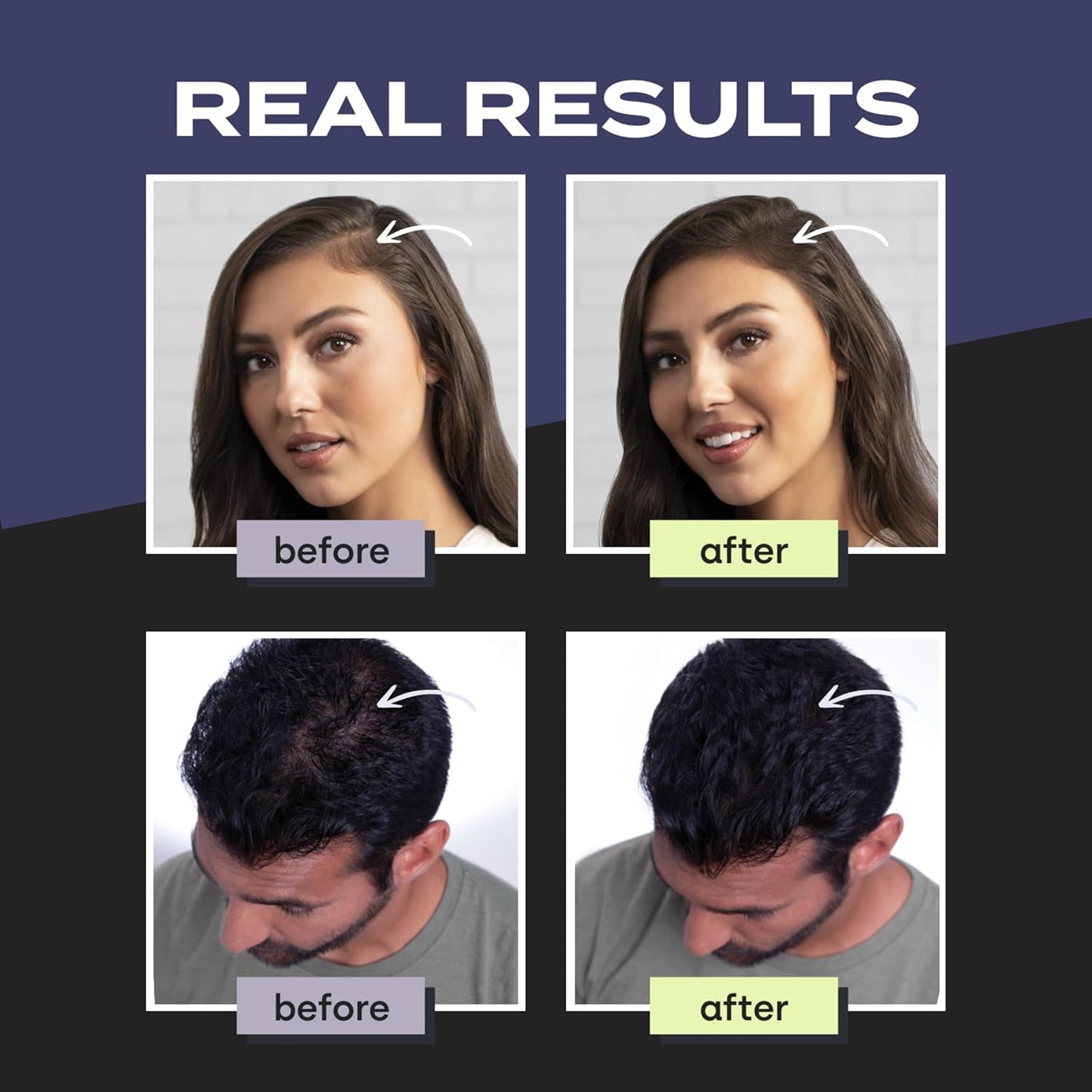 Final 3 Hours [ 70% OFF ]: Topoik Hair Building Fibers (9 Shades)
