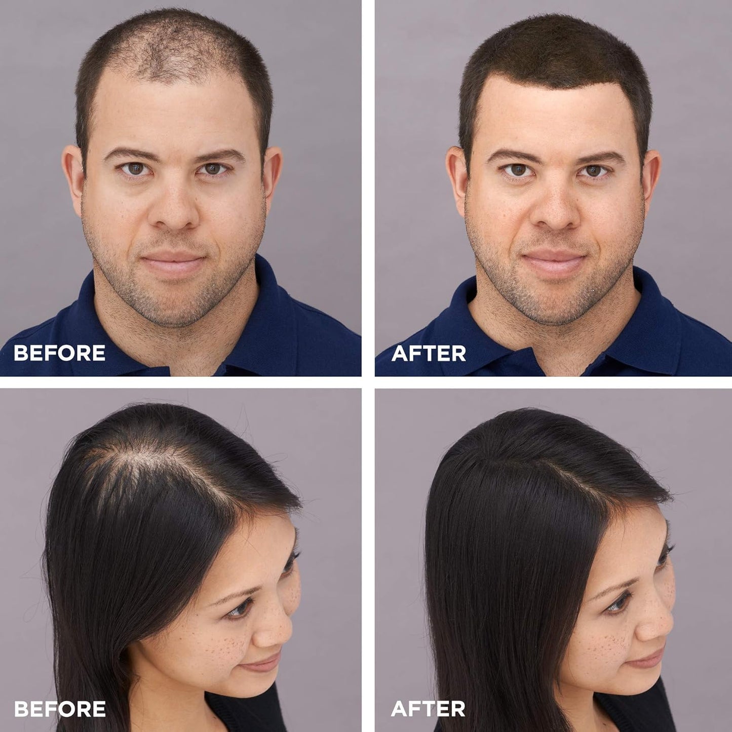 Final 3 Hours [ 70% OFF ]: Topoik Hair Building Fibers (9 Shades)