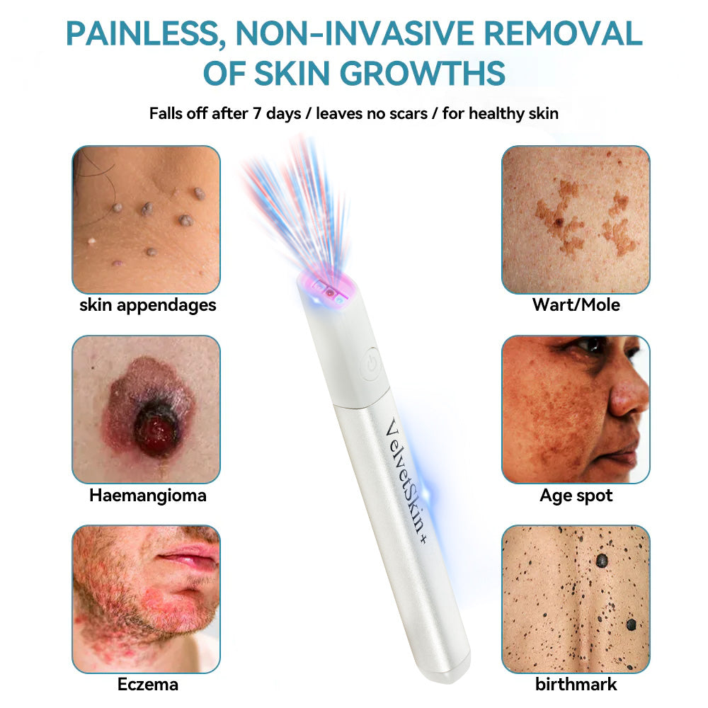 Bikenda® VelvetSkin+ All-in-One Laser Eraser Pen (Powered by CO₂ laser technology – effectively removes moles, warts, skin tags, pigmentation spots, and other skin imperfections)
