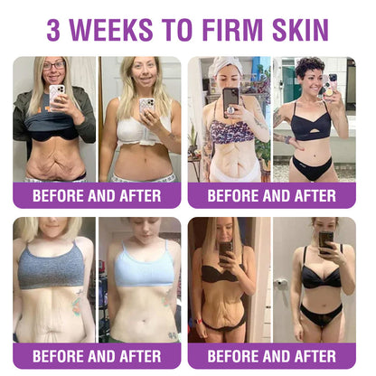 FDA Official: Furzero® Queen Nectar Peptide + Bakuchiol Skin Restoration Cream - Anti-aging, Hydrating, Skin Firming & Lifting, Skin Repair, Even Tone, Acne and Dark Spot Treatment, Wart and Mole Removal, and Psoriasis Relief.