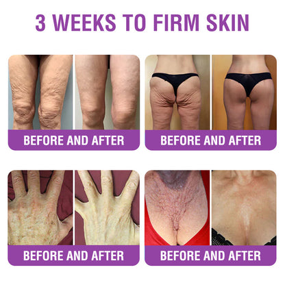 FDA Official: Furzero® Queen Nectar Peptide + Bakuchiol Skin Restoration Cream - Anti-aging, Hydrating, Skin Firming & Lifting, Skin Repair, Even Tone, Acne and Dark Spot Treatment, Wart and Mole Removal, and Psoriasis Relief.
