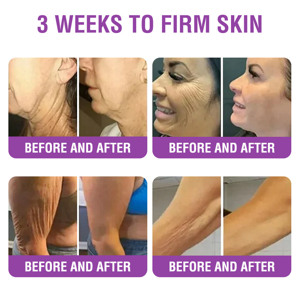 FDA Official: Furzero® Queen Nectar Peptide + Bakuchiol Skin Restoration Cream - Anti-aging, Hydrating, Skin Firming & Lifting, Skin Repair, Even Tone, Acne and Dark Spot Treatment, Wart and Mole Removal, and Psoriasis Relief.