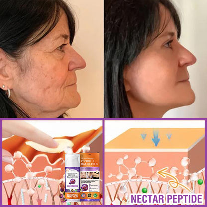 FDA Official: Furzero® Queen Nectar Peptide + Bakuchiol Skin Restoration Cream - Anti-aging, Hydrating, Skin Firming & Lifting, Skin Repair, Even Tone, Acne and Dark Spot Treatment, Wart and Mole Removal, and Psoriasis Relief.
