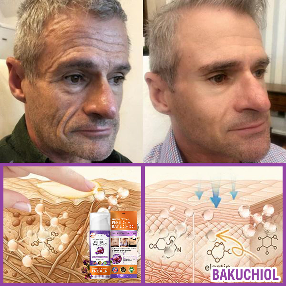 FDA Official: Furzero® Queen Nectar Peptide + Bakuchiol Skin Restoration Cream - Anti-aging, Hydrating, Skin Firming & Lifting, Skin Repair, Even Tone, Acne and Dark Spot Treatment, Wart and Mole Removal, and Psoriasis Relief.
