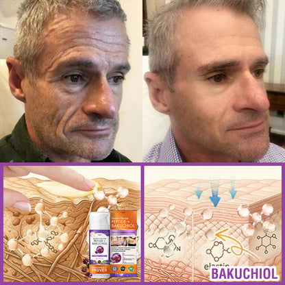 FDA Official: Furzero® Queen Nectar Peptide + Bakuchiol Skin Restoration Cream - Anti-aging, Hydrating, Skin Firming & Lifting, Skin Repair, Even Tone, Acne and Dark Spot Treatment, Wart and Mole Removal, and Psoriasis Relief.