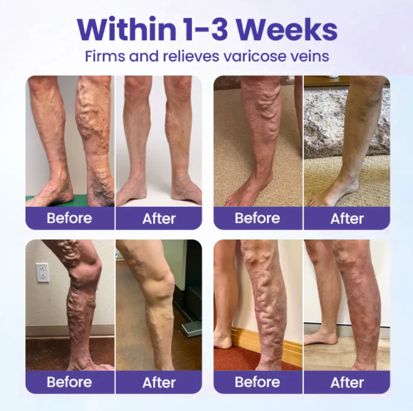 𝐎𝐮𝐫𝐥𝐲𝐚𝐫𝐝® 𝐅𝐞𝐞𝐋𝐞𝐠 𝐂𝐚𝐫𝐞 𝐏𝐡𝐲𝐭𝐨 𝐆𝐞𝐥 - Treat Varicose Veins, Swelling, Cramps, and Leg Pain