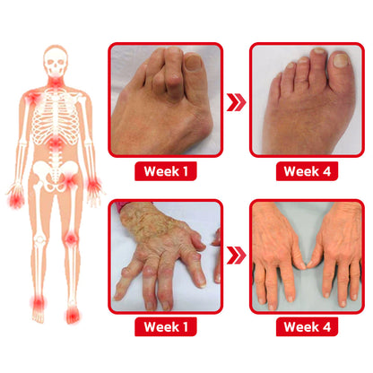 GFOUK™ JointMax Therapy and Inflammation Relief Gel