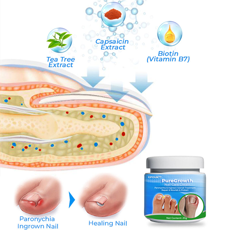 GFOUK™ PureGrowth Nail Care Cream