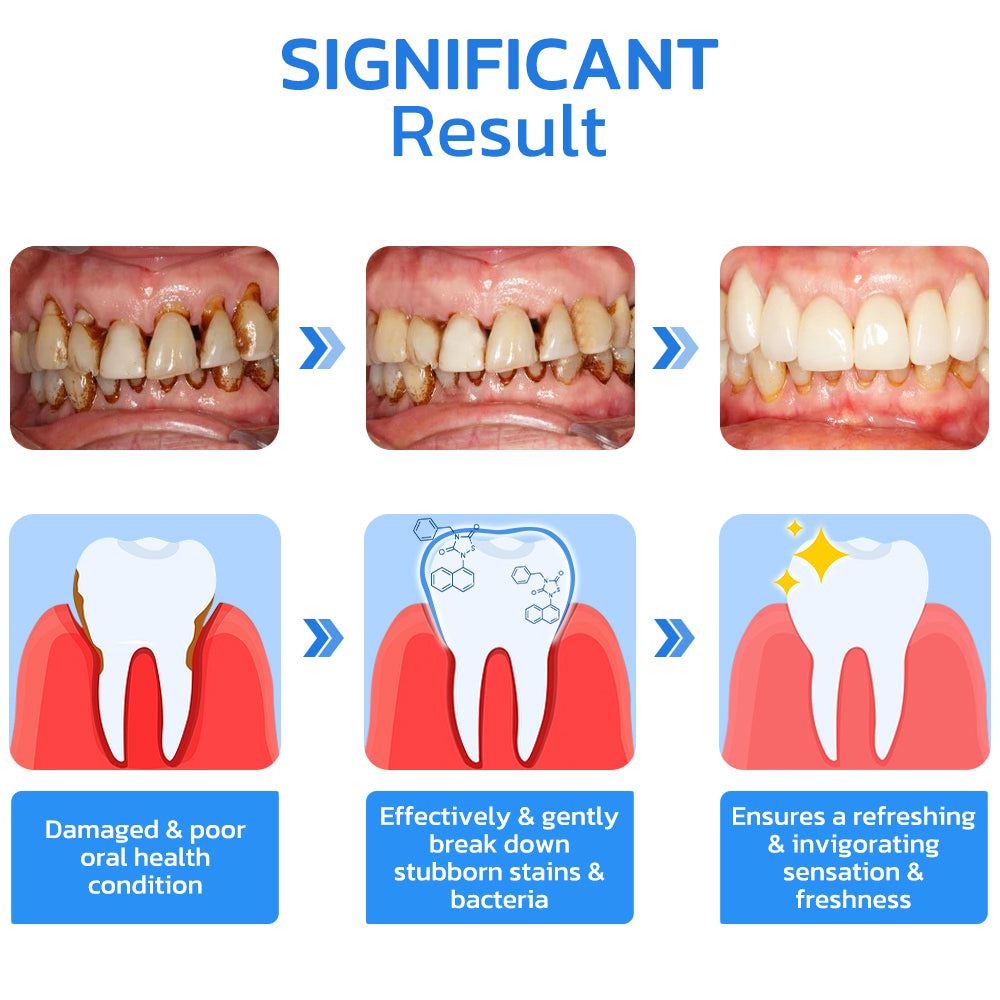 GFOUK™ Gum Repair Strips