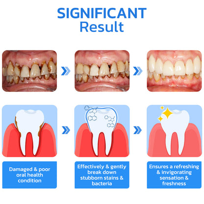 GFOUK™ Gum Repair Strips